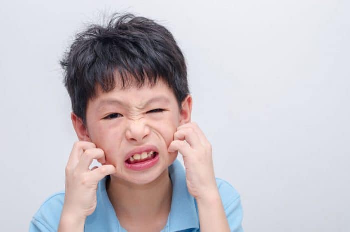 Dermatitis niños