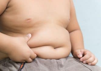 Obesidad infantil