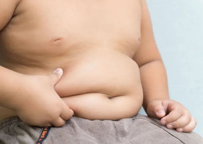 Obesidad infantil: Sus causas y consecuencias