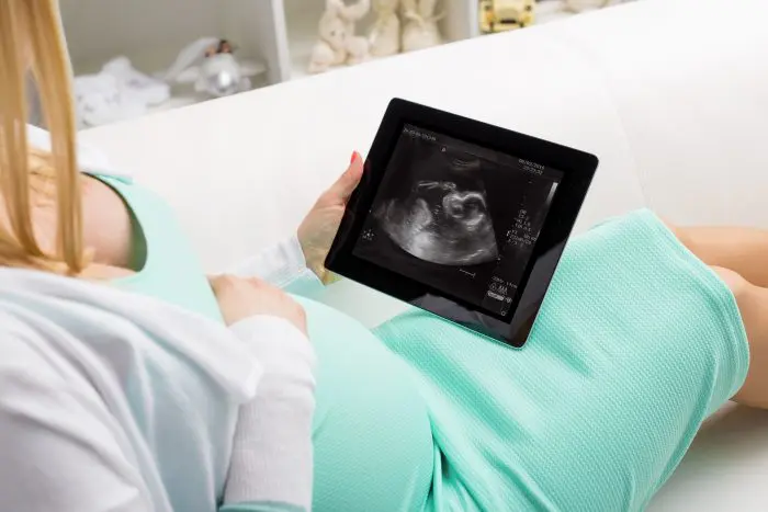 Quería una niña y es un niño