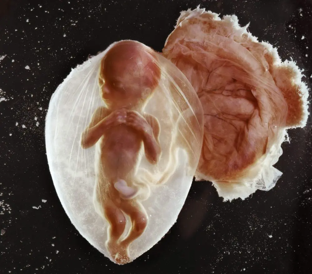 Imágenes REALES e increíbles: concepción y el bebé creciendo durante el embarazo
