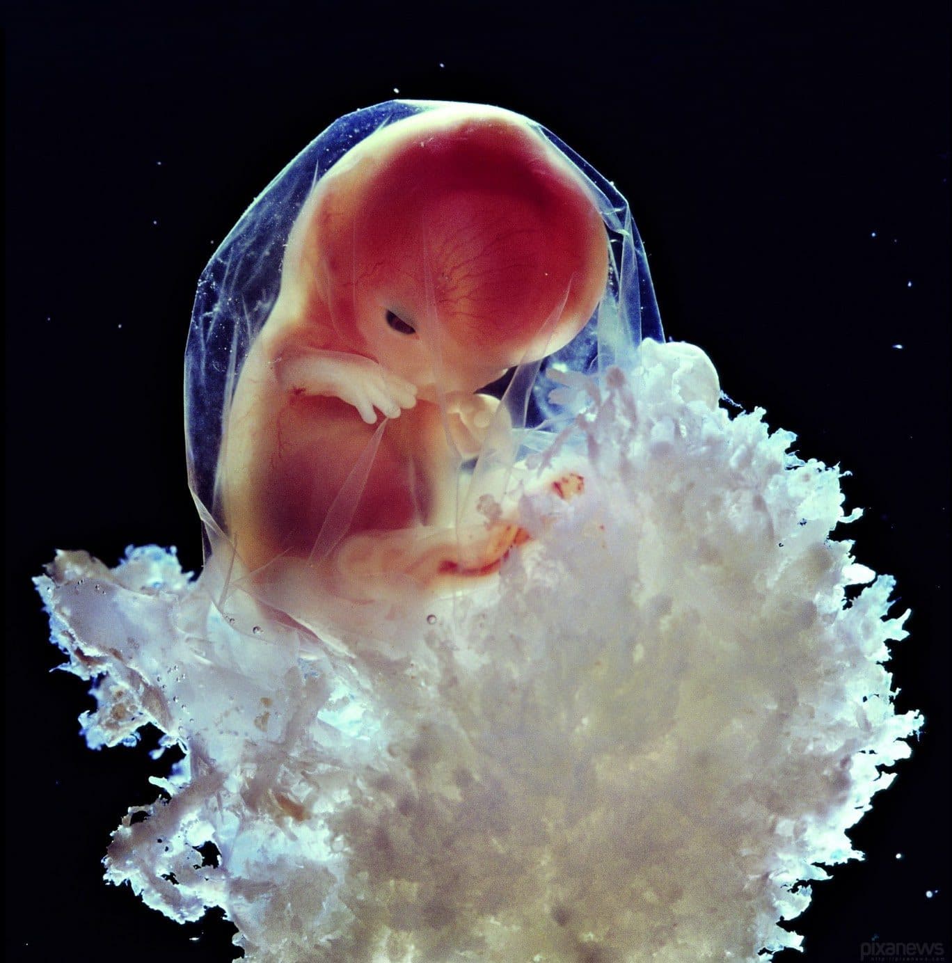 Imagen de feto de 12 semanas de gestacion video