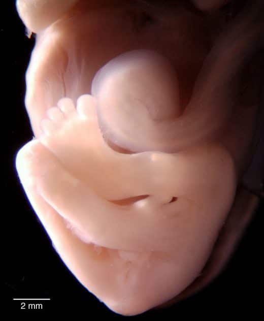 Imagenes reales de feto de 13 semanas