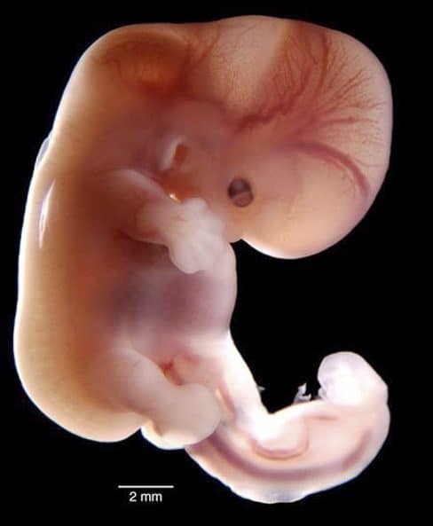 Imagenes Reales E Increibles Concepcion Y El Bebe Creciendo Durante El Embarazo Etapa Infantil