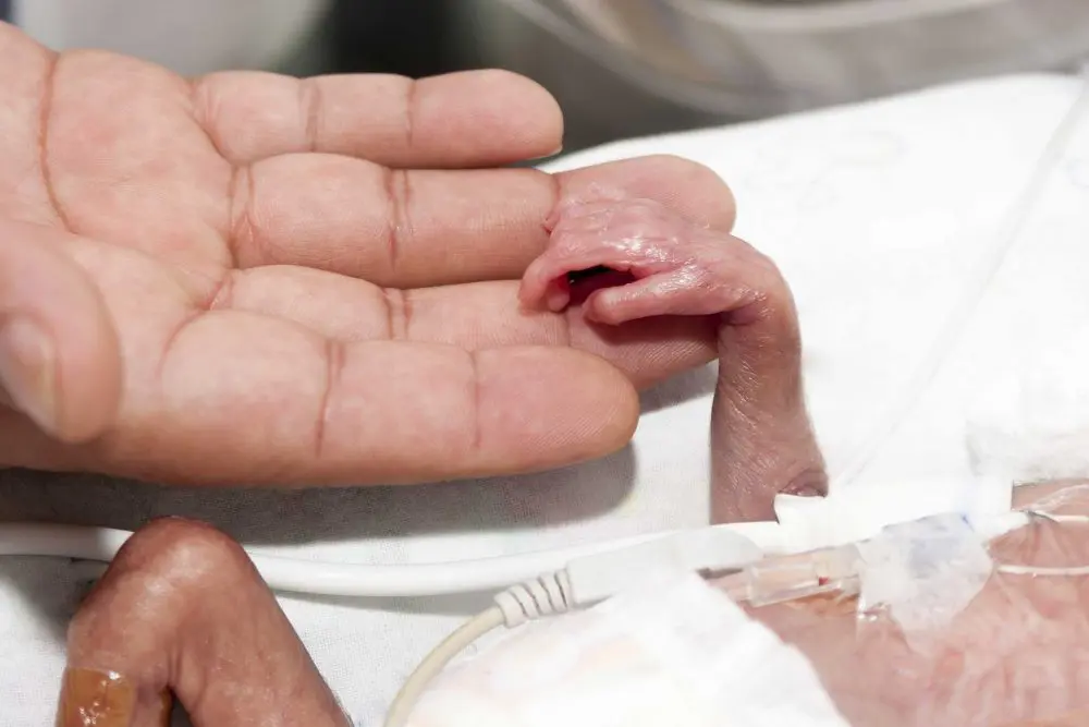 VÍDEO impresionante de un bebé prematuro durante 107 días en la UCI