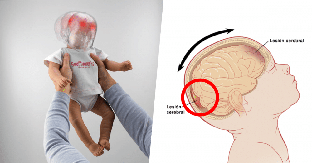 Que Es El Sindrome Del Bebe Sacudido Etapa Infantil Que Es El Sindrome Del Bebe Sacudido Etapa Infantil