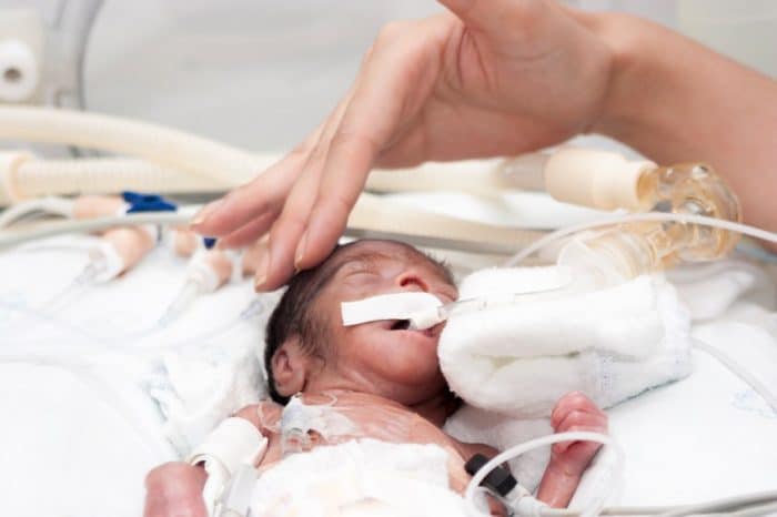 Bebés prematuros suelen padecer de inmadurez del pulmón y sepsis neonatal NOTIGUARO La supervivencia de bebés prematuros con más de 28 semanas alcanza el 95% en España - Etapa Infantil