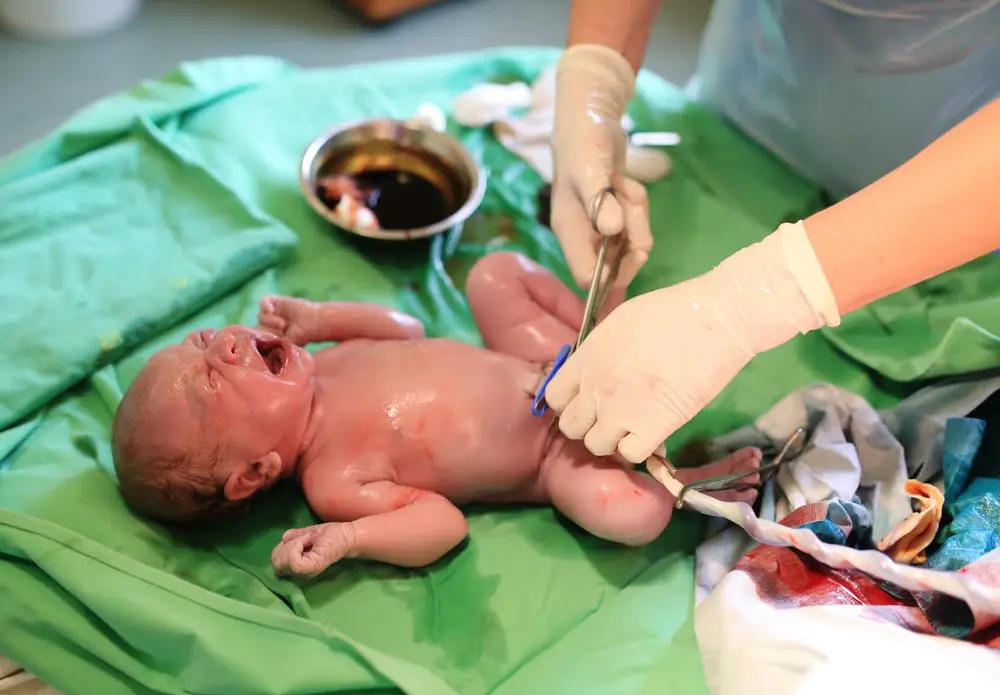Congelar las células madre del cordón umbilical: Ventajas y desventajas