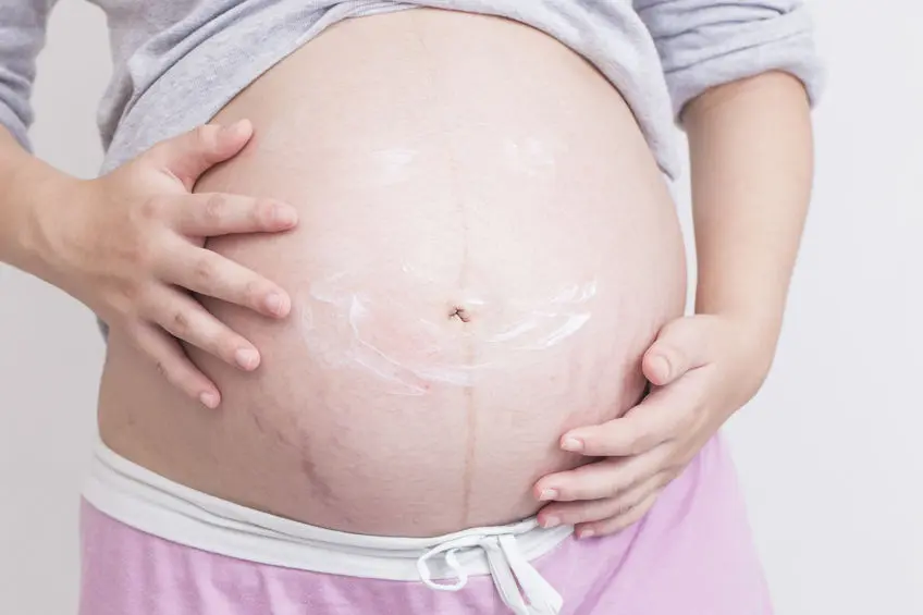 Las estrías del embarazo: ¿Cómo prevenir y eliminarlas?