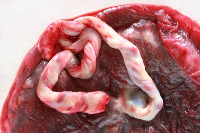 comer placenta despues parto