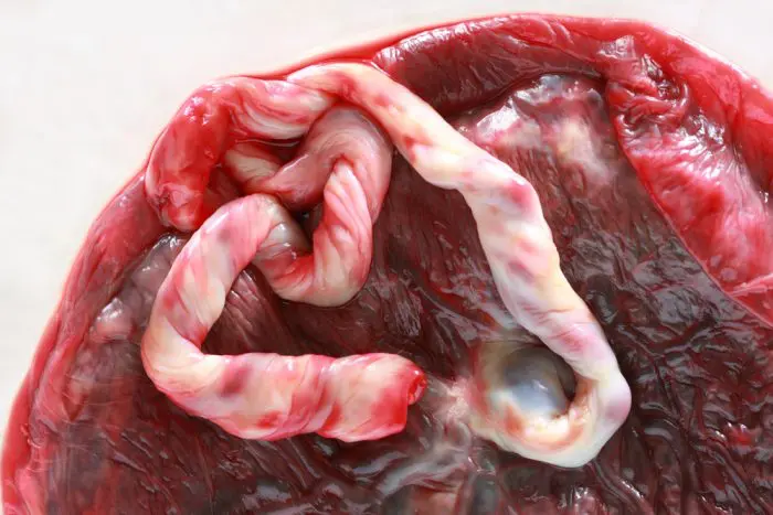 comer placenta