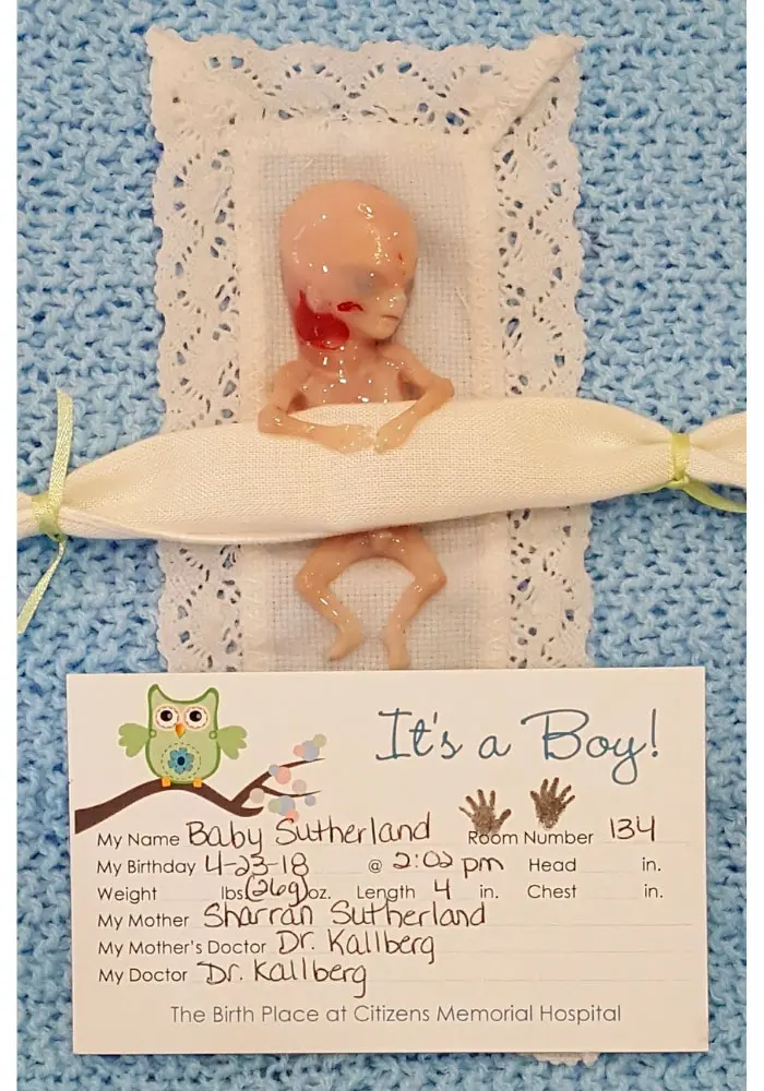 aborto bebe 14 semanas