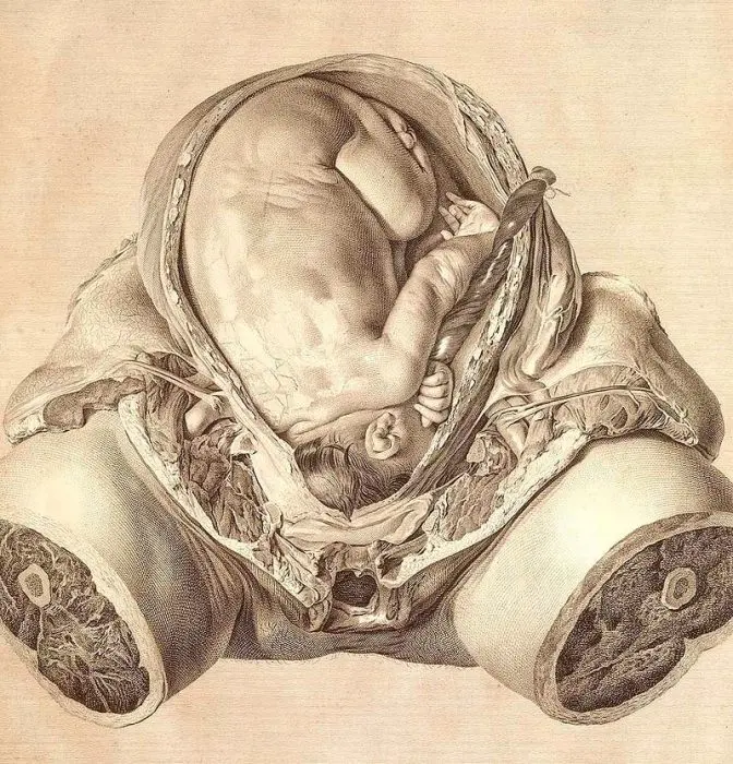 ginecologia obstetricia siglo XVIII
