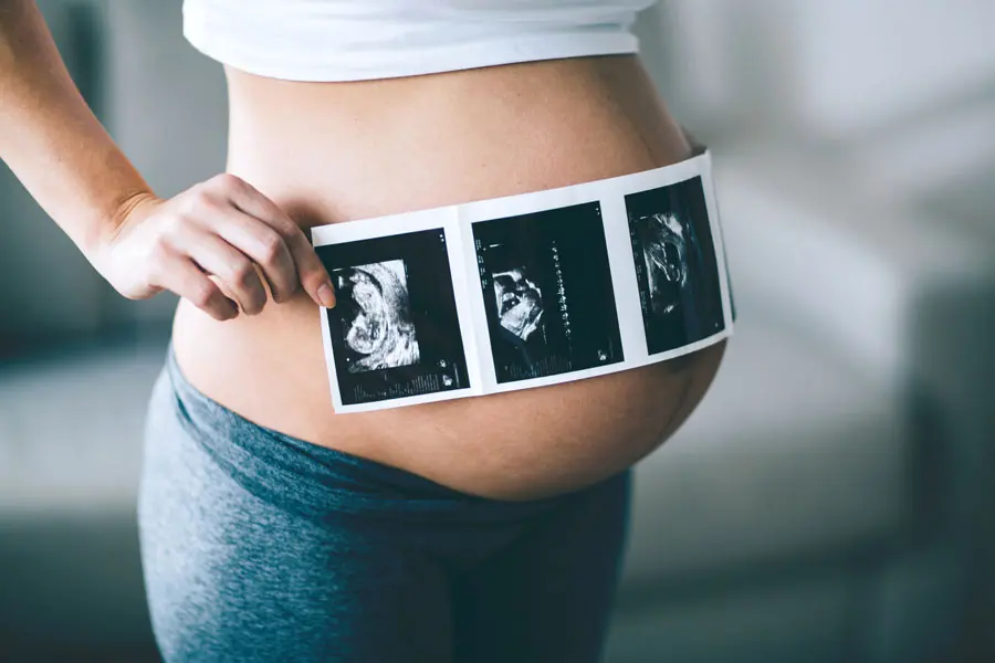 ¿Cuántas ecografías son necesarias en el embarazo?