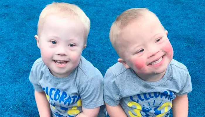 Estos gemelos con Síndrome de Down te contagiarán su alegría