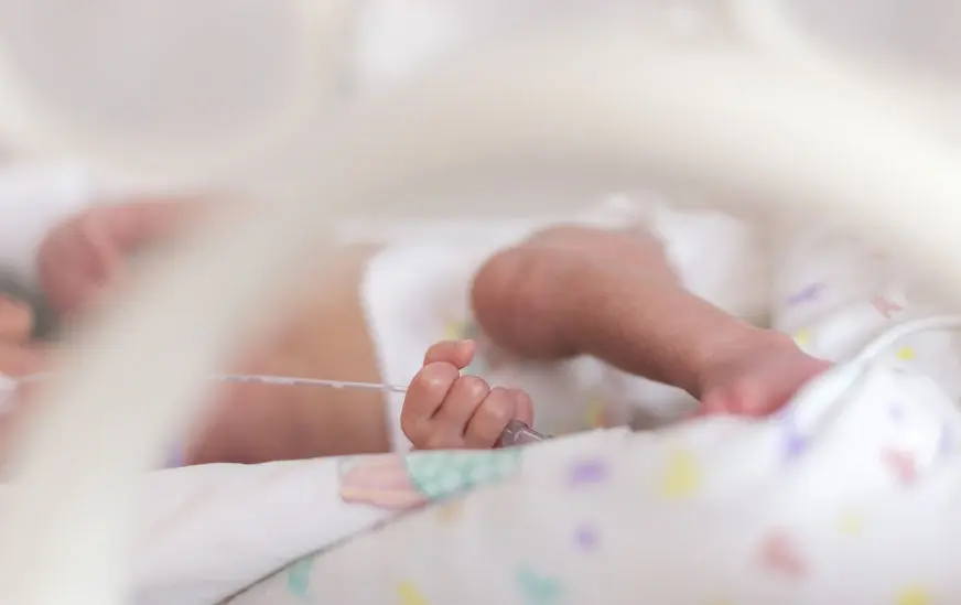 Amputan la pierna de un bebé prematuro por “error”