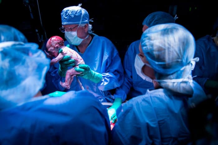 Cleveland Clinic trasplante utero