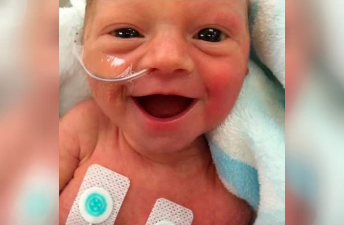 Sonrisa de una bebé prematura que te ablandará el corazón