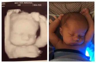 bebé posición útero durmiendo