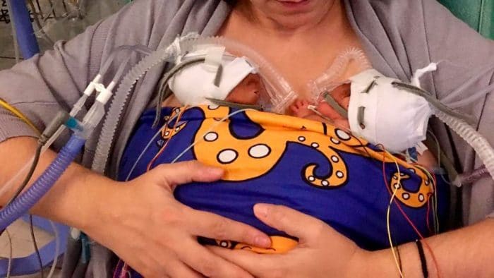 buff neosling bebes prematuros