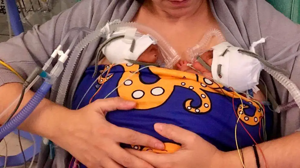 La gran idea de una enfermera para ayudar a los bebés recién nacidos
