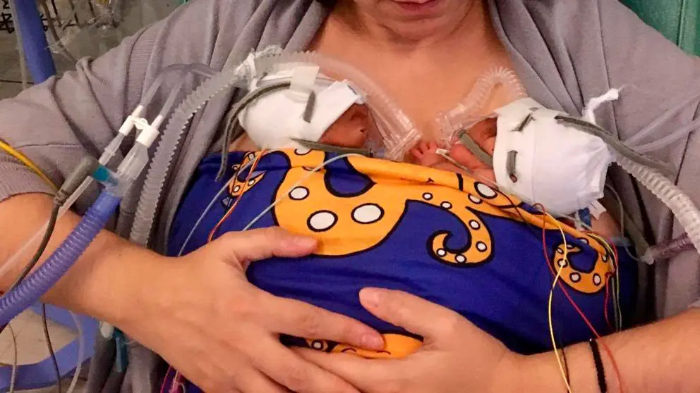 buff neosling bebes prematuros