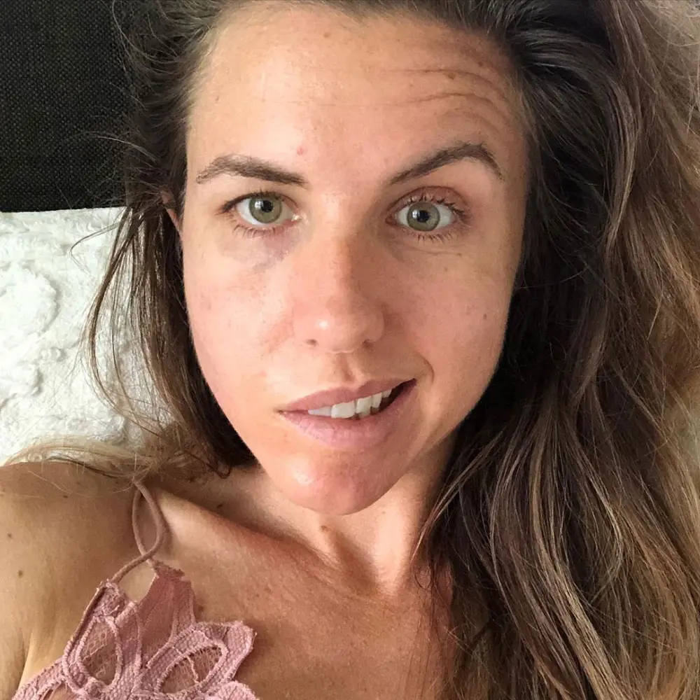 Danielle Ferguson estrés media cara paralizada