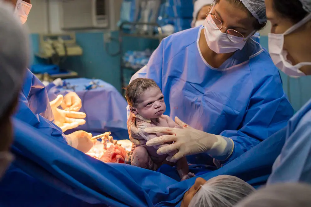 Niña nace enfadada, su rostro no te dejará indiferente
