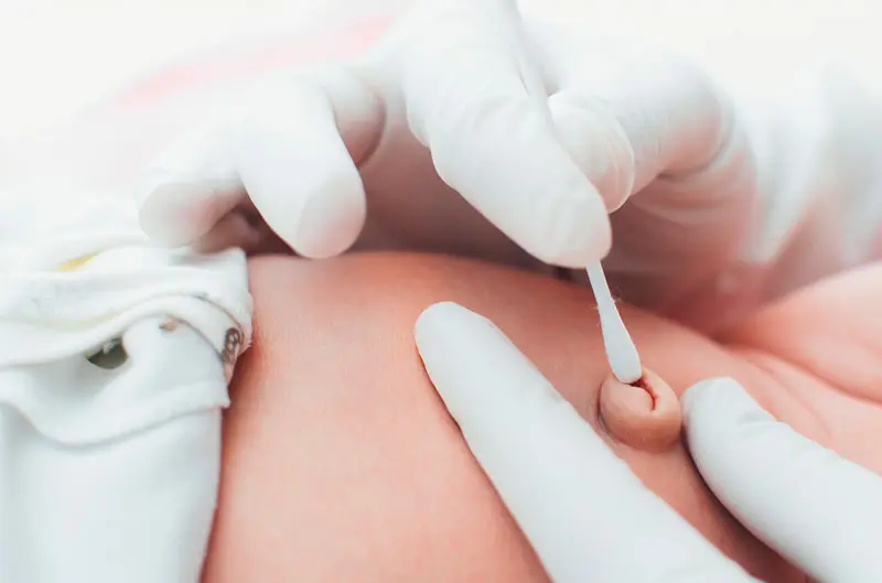 Cómo curar el cordón umbilical del bebé