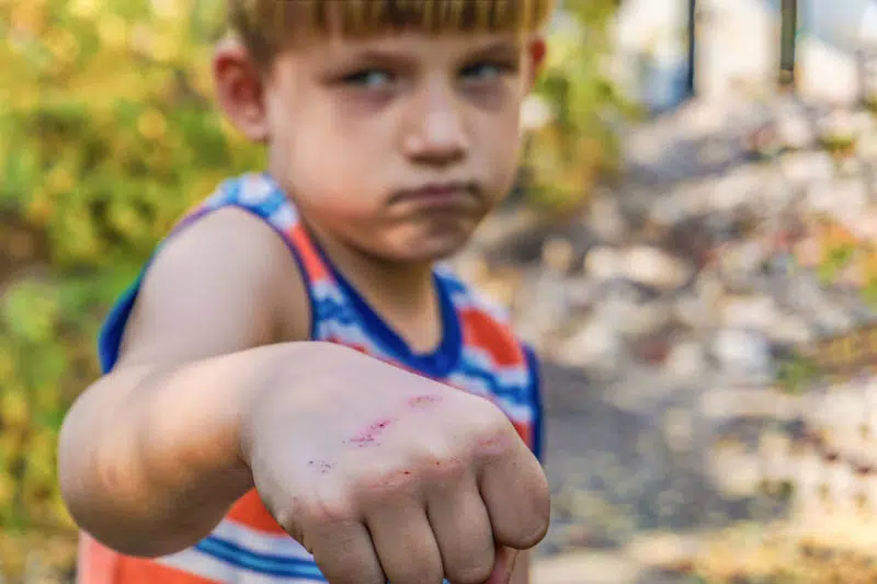 Qué hacer con niños que pegan