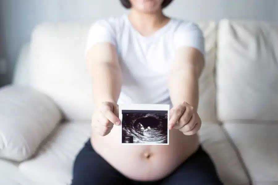 Foto ecografía barriga embarazo