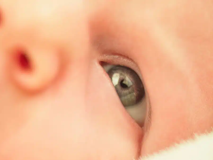 color ojos recién nacido